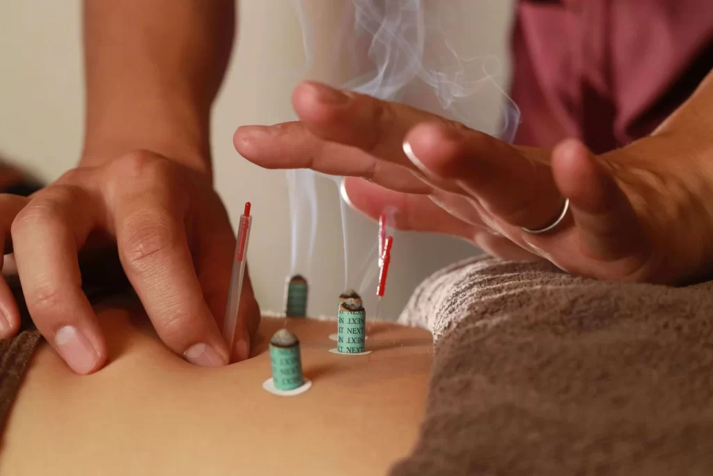 痛みに対する鍼灸治療